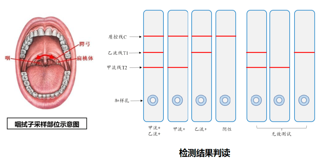 流感病毒来势汹汹,是不是感染了甲流?如何检测,一文读懂! (图3) 流感病毒来势汹汹,是不是感染了甲流?如何检测,一文读懂! (图3)